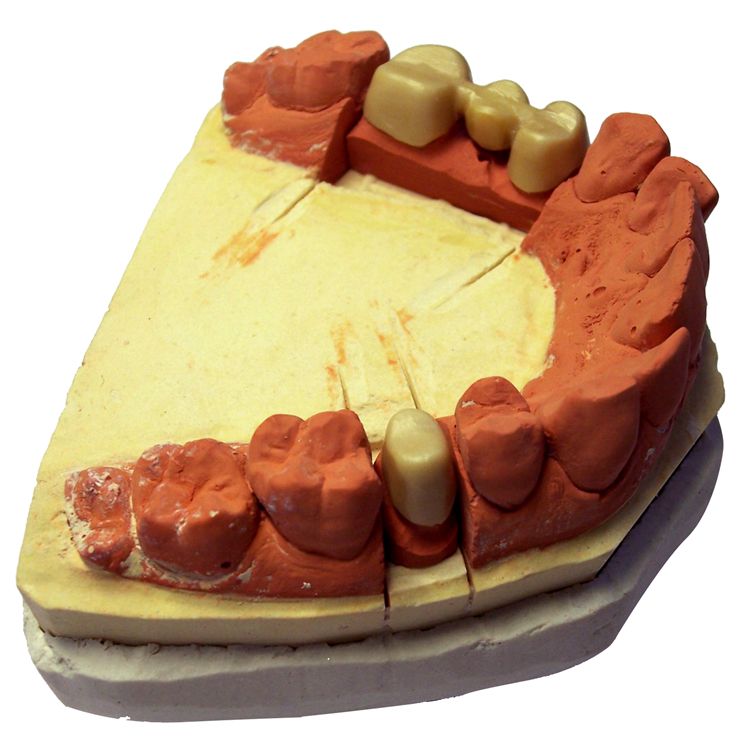 Picture Of Dental Mold With Path