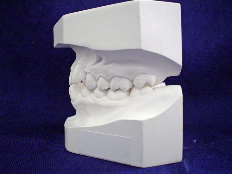 Picture Of Dentist Mold